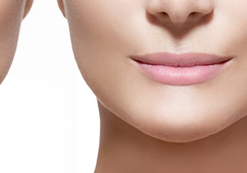 Which Dermal Fillers Last the Longest?