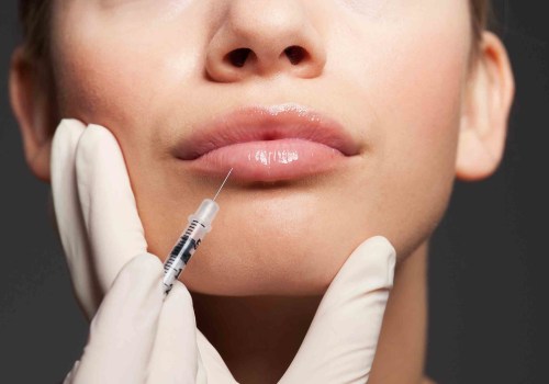 Are Dermal Fillers Painful? An Expert's Perspective